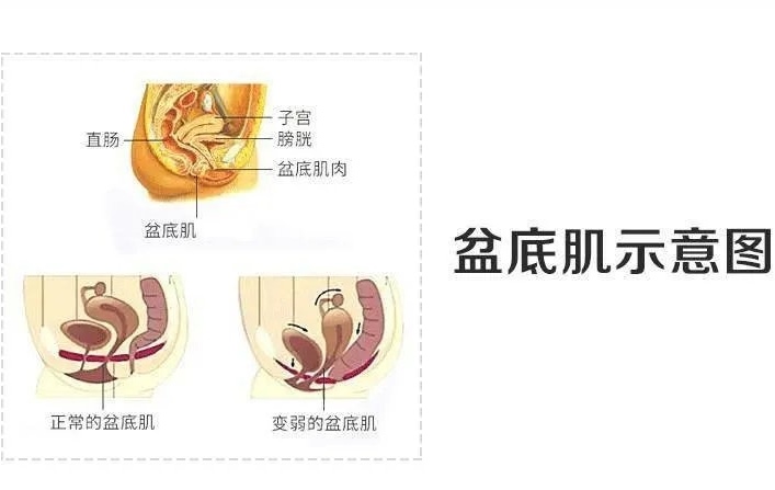 🌟在目前的非常时期，我们更应该把居家训练融入到日常生活，随时随地练起来。
🌟凯格尔运动，帮助你强健盆底
