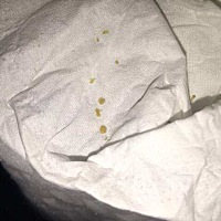 这是中耳炎吗？