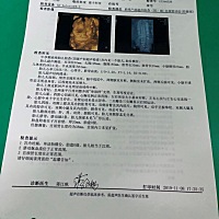 第六感超强，一直感觉自己怀的是男宝宝，孕期梦见过几次蛇。没有孕吐反应，酸甜辣都爱吃，从不忌口，有...