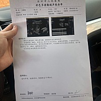 医生说都挺好 会看的姐妹们可以看出来男宝还是女宝吗 怀孕7周也没吐过 真是个神仙宝贝  孕酮怎么样呢 可...