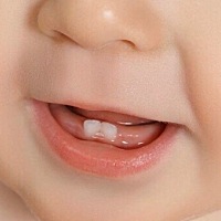 一般来说，宝宝6个月左右就会萌出乳牙，到这个阶段，爸妈可以留心一下这些长牙的征兆了： 1、 最明显的...