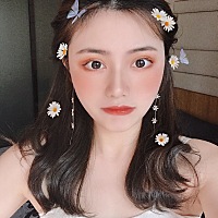 这是我割的双眼皮第30天 你们说怎么样