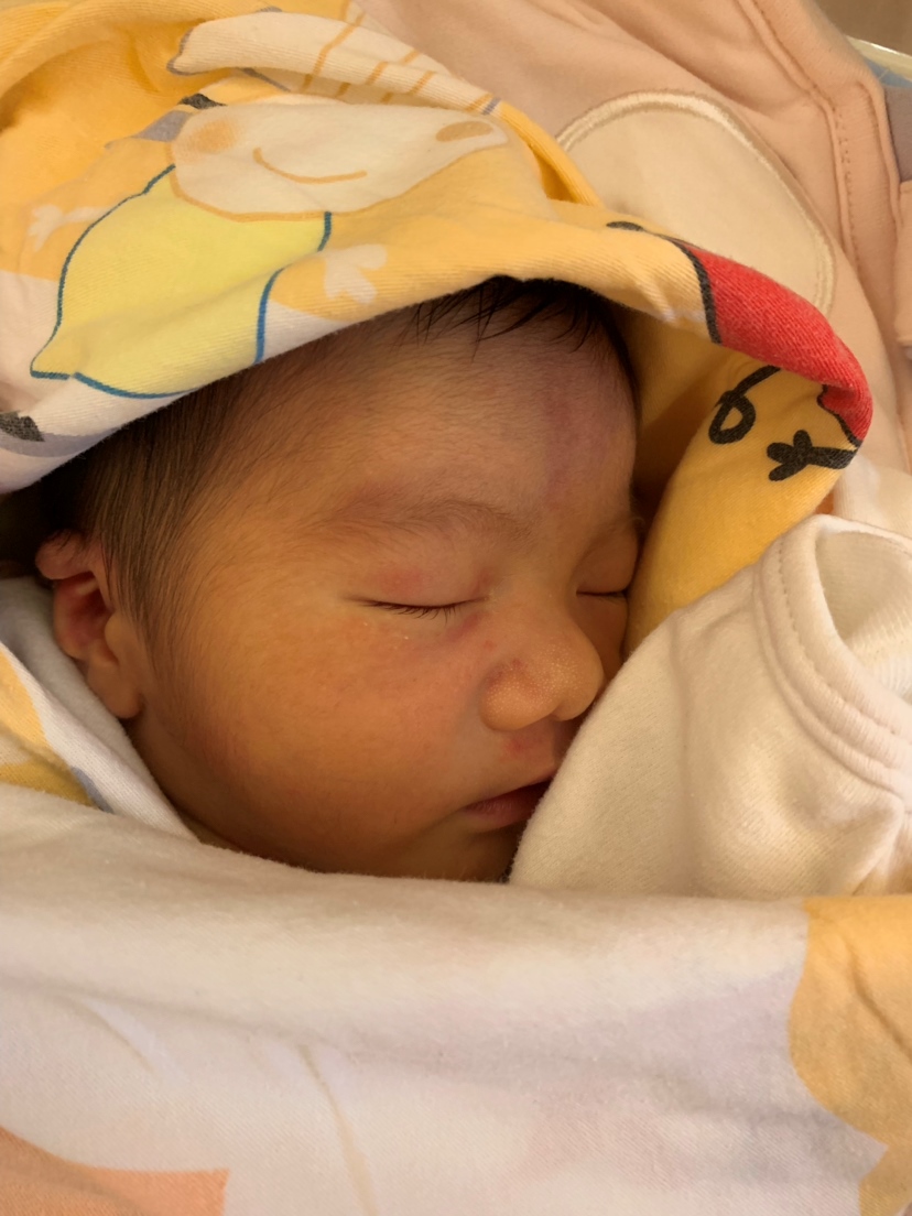 宝宝出生的第二天做了催乳按摩，第三天准备给宝宝喂奶时发现黄疸高了，马上送去监护室观察3-5天，但是问题来了我现在开始涨奶了，痛得我怀疑人生