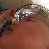 先是红的后来就变成了像水泡一样是硬的了，宝妈知道是怎么了吗