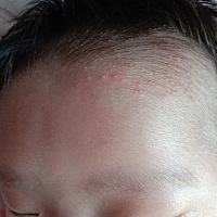 宝妈们能不能帮我看看我家宝宝头上是什么东西，