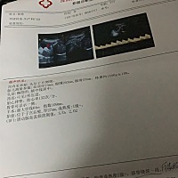 31周了，今天去检查说胎儿有点偏小，还胎位不正，我点害怕！