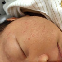 一直都是母乳喂养，是不是吃的饮食有关？月子里一直都清淡，没有刺激的东西，宝宝这两天脸上长得小红点...