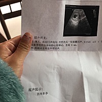 我是1月29号来的，到现在24天没有来姨妈了是不是来怀孕了？