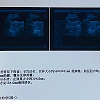 这个是正常的吗 5周➕看不到胎心和胎囊吗？