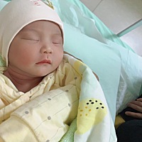 在家怎么测黄疸呢？