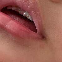 本来刚长出来就缺一点牙。现在是两层了 有宝妈知道怎么回事吗