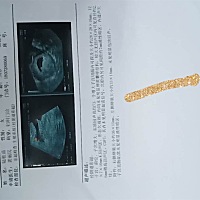 还有希望吗？还能拯救吗？