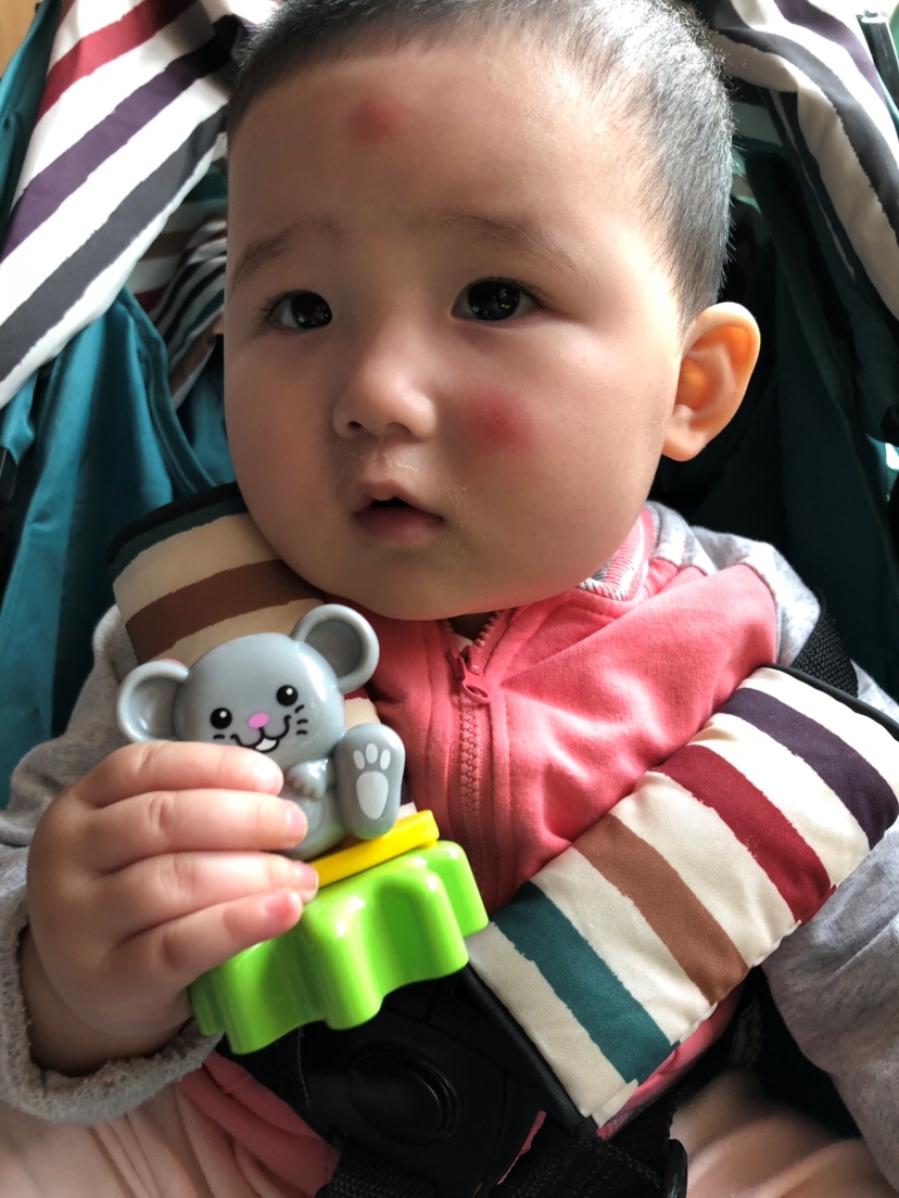 天气逐渐热起来了，头发剃了，脸上的是蚊子叮的，额头是站着玩撞到墙了，都怪宝爸没看好