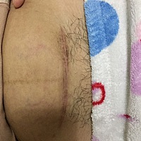 都三個多了，腰疼，傷口疼，全身骨頭疼，寶貝媽媽一個人帶你，要乖乖的喔，我們一起加油，要是媽媽有錢...