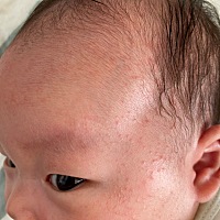 请问宝宝这是长的湿疹吗？要怎么处理？