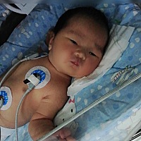 👶出院的时候黄疸10.5当时产科医生说回家观察一下，隔天回医院测一下黄疸，第7天去医院测16.6。儿科医...