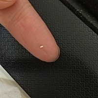 该死的堵奶，每次都是这种脂肪粒堵住，都马上七个月了奶水宝宝还是吃不完，郁闷死了