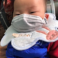 1号带你去剪舌系带，护士说你好乖，选择带口罩
