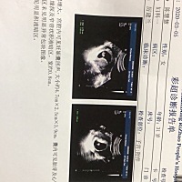 我现在是十周➕3到现在没有去医院检查～我是四周去拍的B超，医生让十二周直接去拍NT～在家里天天盼着数...