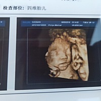 胖胖的小石榴