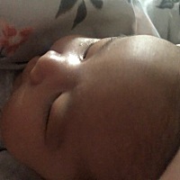 各位妈妈们 请问一下我女儿鼻子到额头中间有一条凸出来的棱 是什么啊 正常吗