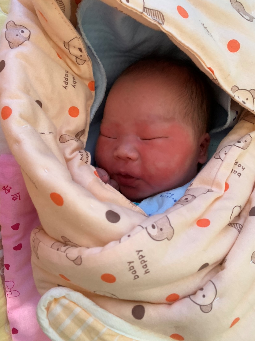 3月31号，出生第二天照片