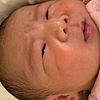 都10多天了，眼睛还这样是怎么回事啊……