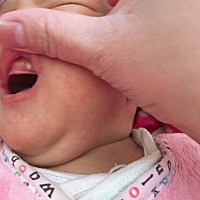 小儿难养看着宝宝这样又不知道怎么做，心情郁闷哦