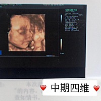 中期四维时候，内心：怎么办这么丑，生出来了怎么办，不过鼻梁还是高的，没关系没关系。晚期四维，内心...