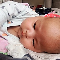 我老闺今天是经历了什么……早上给她吃扎扎的时候发现她鼻子以上红的一块一块的，都抓花了，之后老公给...