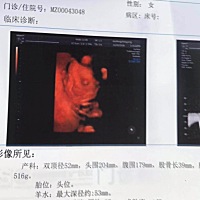 第一次这么清晰的照片，人家有点害羞呢！露半张脸好啦～