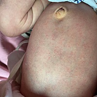 腿上 肚子上 脖子有这种红点点 这是啥啊 有知道的宝妈吗？