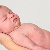 有20%的宝宝会发生新生儿痤疮，多在宝宝出生后两周至3个月龄出现，是正常的生理现象，家长不用担心。 一...