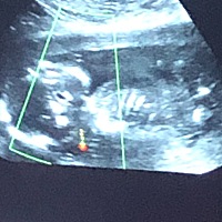 我的金鼠宝宝卸货了，姐姐叫了10个月的弟弟，如愿了