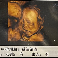 接了一个孕期的男孩，生出来也是男孩，儿女都有了，很满足了，接下来该宝爸努力给他们创造好的生活环境...