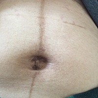 请问这条黑线啥时候可以掉？