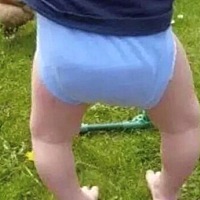 O型腿需要从小预防，一般来说，爸妈可以这么做： 从宝宝出生后的第15天就要补充维生素D，维生素D能促进...