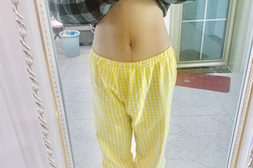 产后肚子