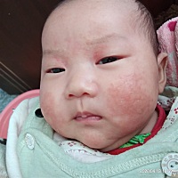 最近宝宝闹湿疹，擦了药也没效。这几天又肠胃不好，奶水又不足，一直吃奶粉。有没有宝妈建议什么是下奶...