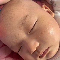 从医院回来就一直开始长湿疹，到现在一个多月了都没有好，去打预防针人家也不给打。要怎么办啊？？愁死...