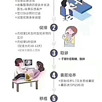 正确认识试管流程，在试管中少走弯路。