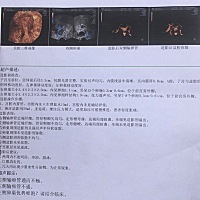 艰难备孕中
