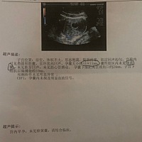 第一次B超就被医生吓的半死，如果你也碰到这样的事情，我建议你先不要慌，要知道，宝宝比我们想象的要坚...