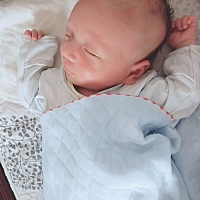 湿疹要怎么处理？