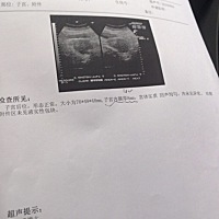 什么意思啊