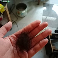 以前没生孩子也会掉头发，但是没有这么严重。现在每天梳头都会掉很多头发，洗头就掉的更多了，一大把一...