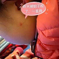 这个我们家宝宝自用效果非常好。