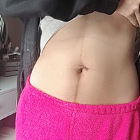 二胎生完第三个月 两胎都一样恢复很快。