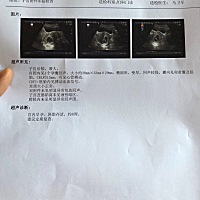 各位宝妈们大家好！感谢怀孕管家和圈里姐妹们整个孕期的陪伴！       说说孕期症状： 整个孕期喜酸，后...