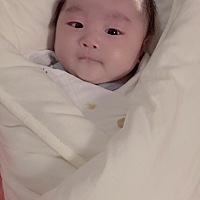 小朋友刚出生就有一点溢脂性皮炎了，之前一直不知道，总以为是胎脂没掉，那个时候胎毛还没剪也没发现乐...